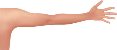 Arm